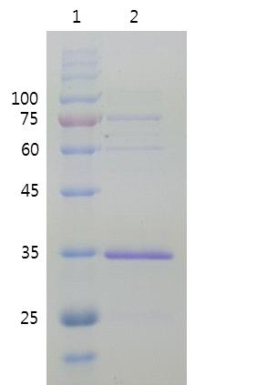 elution buffer 100 %로 용출한sample 40 ml을 농축한 SDS-PAGE (12% Tris-Glycine)