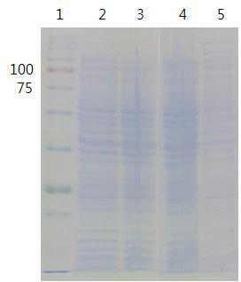 pKJE7/BL21(DE3) competent cell을 이용한pET41b TBH의 SDS-PAGE (12% Tris-Glycine)