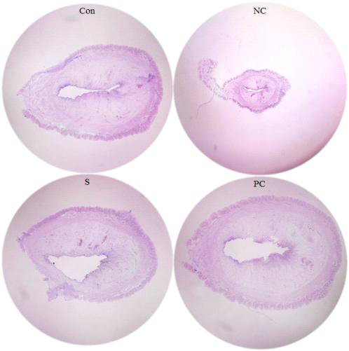 Effect of ovariectomy and the ascorbic acid/α-tocopherol or the sample treatments on uterus tissues.