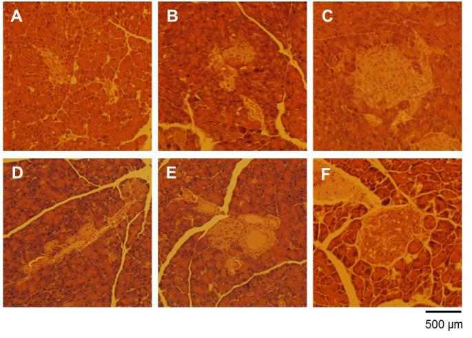db/db 당뇨 모델 마우스에서 손상된 췌장의 랑게르한스섬의 복구 효과 확인