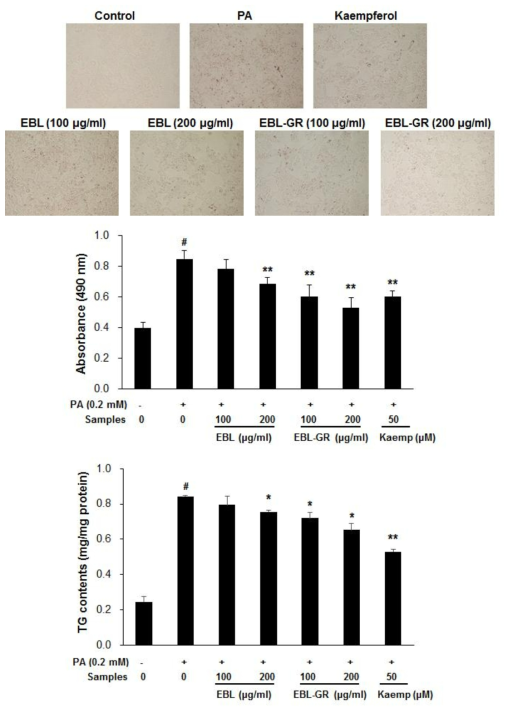 Effect of EBL and EBL-GR on palmitate (PA)-induced lipid accumulation in HepG2 cells. HepG2cells were seeded into a 24-well plate at a density of 1 × 105 cells per well and grown for 24 h. HepG2 cells were treated with PA (0.2 mM) for 24 h. quantification of TG contents in HepG2 cells. Values are presented as mean ± SD. #p < 0.01 versus media alone-treated group. *p < 0.05, **p < 0.01 versus PA alone-treated group. Kaemp: kaempferol.