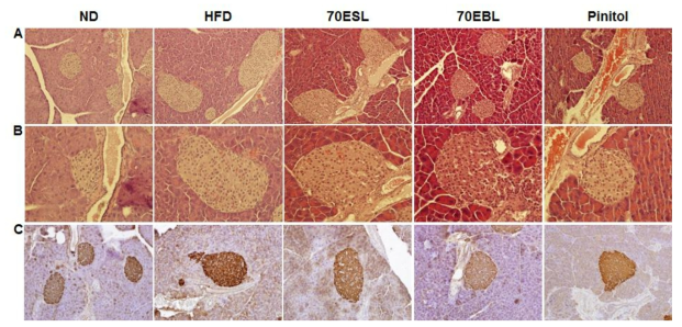 Histologic analysis of the pancreas with H&E (A and B) and insulin IHC (C) staining in HFD-fedC57BL/6J mice. Pancreas were fixed overnight in 10% formalin, embedded in paraffin, and 5 μm thick sections were mounted on slides. Original magnification (A, C) 200x and (B) 400x.