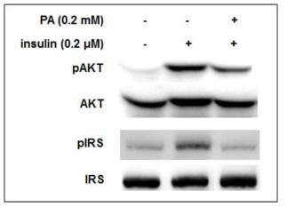 PA (palmitate) induced insulin resistance in HepG2 cells. Cells were grown in culture media(low/high glucose) with 0.2 mM PA for 24 h. And then induced by 0.2 μM insulin for 20 min. The protein expression were detected by Western blot analysis. Cell lysates were prepared and subjected to Western blotting using specific antibodies.