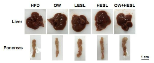 Representative photographs of liver and pancreas from each groups.