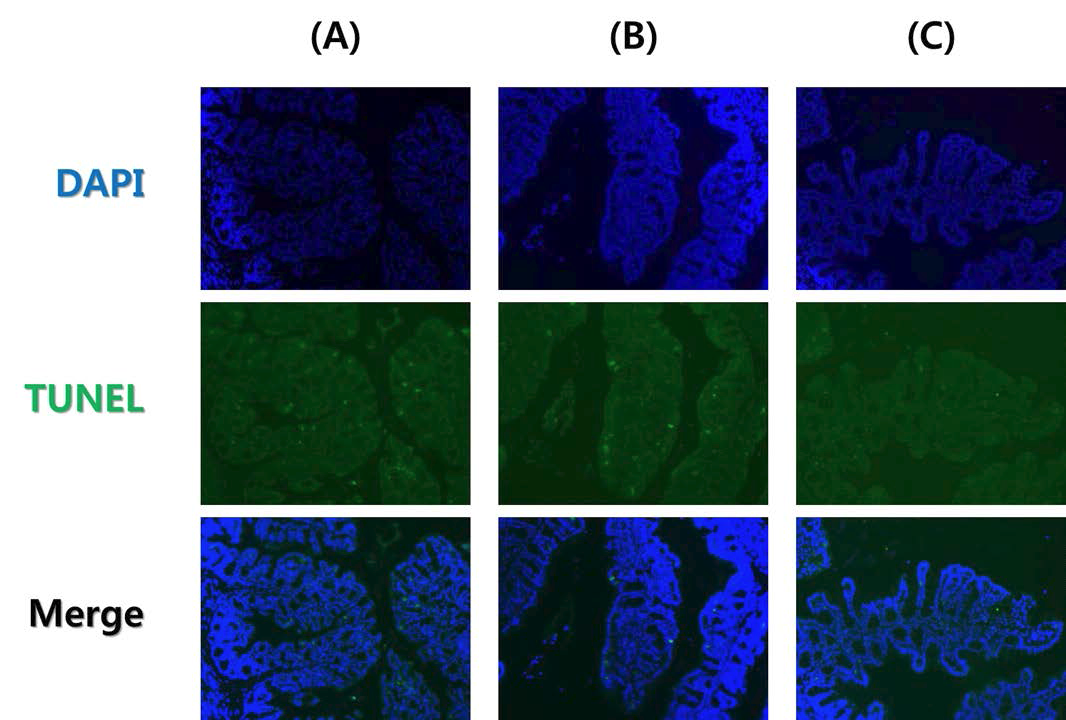 Colon 조직의 TUNEL assay.