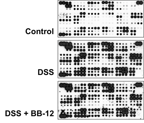 Serum의 cytokine array.