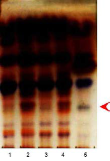 DNPH derivative analysis of bee-honey