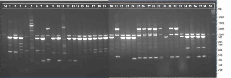 REP-PCR profile of 37 isolates Leu. mesenteroides isolates studies based on ERIC primer on 1.5% agarose gel
