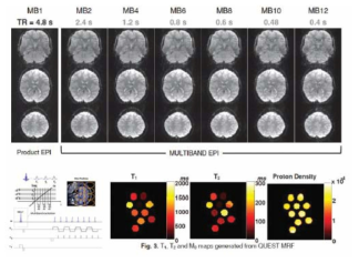 초고속 MRI 영상장치