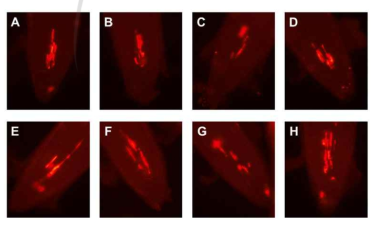 RdDM 돌연변이체들의 감마선 조사후 1일째 cell death assay.