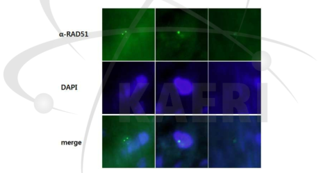 감마선 조사후 RAD51 foci 형성