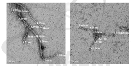 Effect of electron beam irradiation on the shape of microfibrillated cellulose made from Sw-BKP.