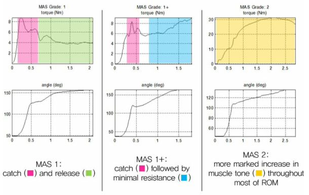 MAS 1, 1+, 2의 특징과 그에 부합하는 경직 반응 개형. MAS 1 (왼쪽), MAS 1+ (가운데), MAS 2 (오른쪽)