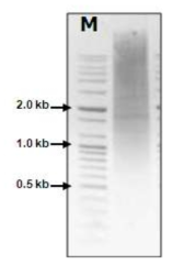 ds cDNA 합성 후 5㎕ 전기영동 확인.