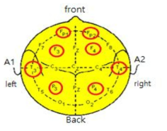 10-20 전극법