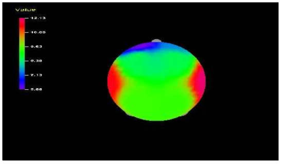 Average Eyes Open-SEF50% EEG of Control Group