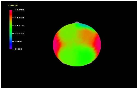 Average Eyes Closed-SEF50% EEG of Experiment Group