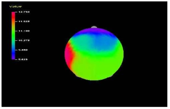 Average Eyes Closed-SEF50% EEG of Control Group