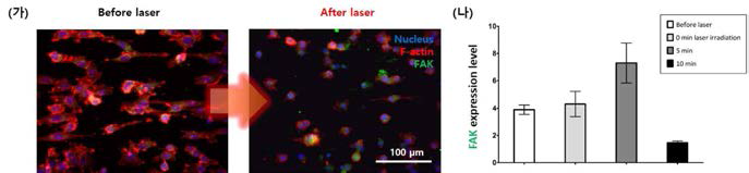 레이저를 조사 1일 후의 암세포 형태를 GFP를 띠는 암세포를 이용하여 형광현미경으로 나타낸 사진 (Green: GFP, Blue: Nucleus, Red: F-actin, scale bar = 200μm)