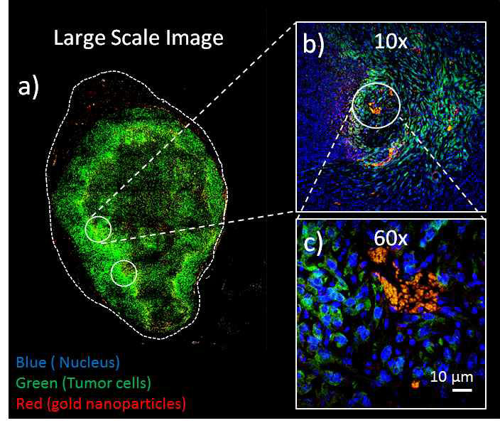 공초점현미경을 통하여 암조직내의 금나노입자의 분포양상을 관찰.