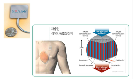 Biophan사의 인체삽입형 열전발전기