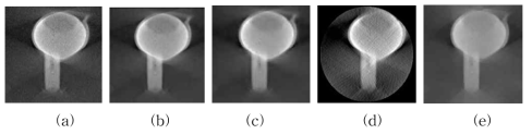 (a) 원본영상에 대한 (b) BM3D, (c) 웨이브렛기반 CS Denoising, (d) EST 및 (e) TVM 영상 처리 결과