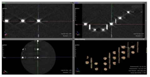 적층구조 시료의 3D CT 이미지 - 저배율 (FOV 570um)