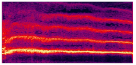 Spectrogram of abnormal voice.