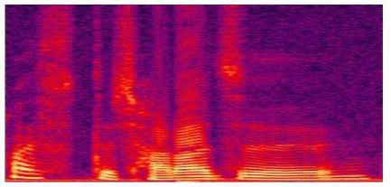 Spectrogram of normal voice.