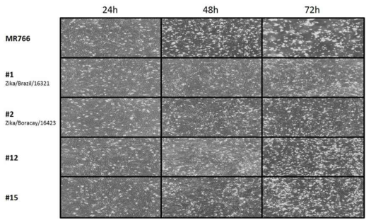 BHK21 세포에서 지카바이러스 5종 감염에 따른 세포 변화 (x100)