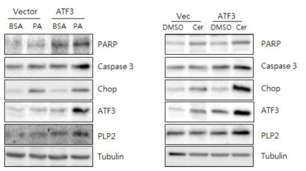 ATF3 과발현으로 인하여 PLP2, Chop, 활성화된 Caspase 3 증가