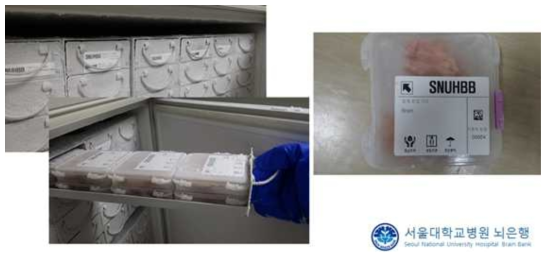 서울대병원 뇌은행 초저온냉장고 보관 모습