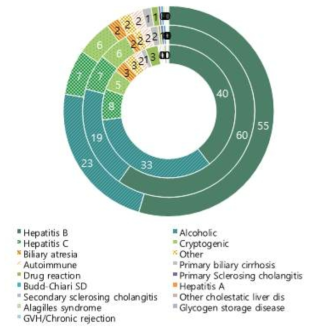 주요 원발성 간질환