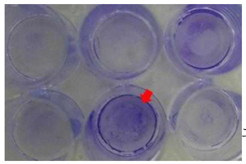 황색포도상알균의 biofilm 형성