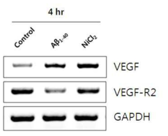 HUVEC에서 아밀로이드 베타에 의한 VEGF receptor의 유전자 발현 조사