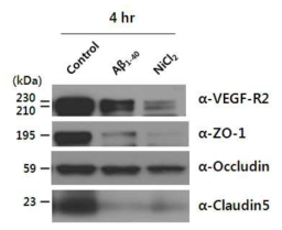 HUVEC에서 아밀로이드베타 및 NiCl2 의한 tight junction 관련 단백질의 변화