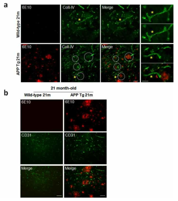 치매동물모델의 amyloid-plaque 침착에 따른 뇌혈관의 손상성 측정