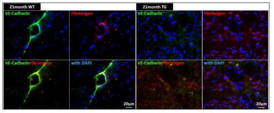 치매동물모델의 뇌혈관 BBB junction표지자(VE-Cadherin) (VE-Cadherin)와 뇌혈관 손상표지자(Fibrinogen)의 발현 조사