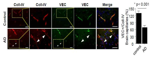 뇌혈관 BBB junction 표지자인 VE-cadherin의 감소관찰