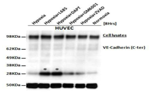 hypoxia 조건에서 γ-secretase에 의한 adherent junction의 지표자 (VE-Cadherin)의 손상과의 상관성 확인
