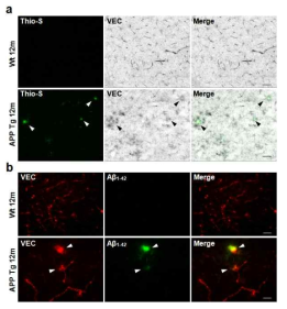 알츠하이머치매의 세포외 분비된 sVE-cadherin과 amyloid-plaque의 공동국지화