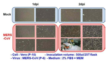 MERS-CoV CPE 확인