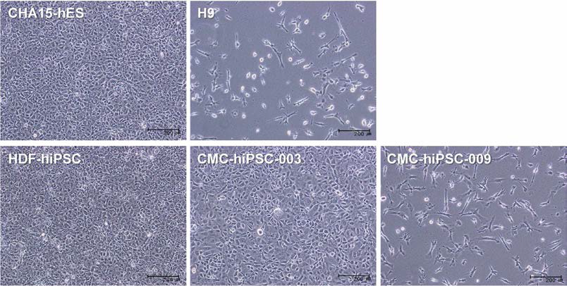 LY294002를 추가하여 분화를 유도한 내배엽 세포.