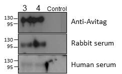 S1 단백질 Western blot. 3가지 primary antibody를 사용