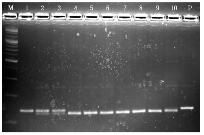 PCR-RFLP analysis of ALDH2 gene.