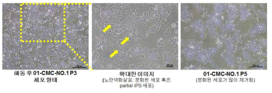 01-CMC-iPSC (p3) 세포주의 유지 배양