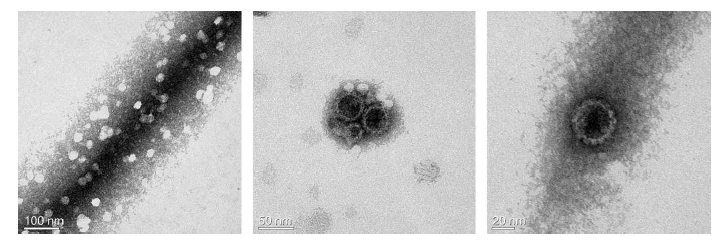 Sf9 세포에서 발현하고 정제한 HPV16 VLP의 전자현미경 결과