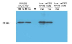 Sf9 세포에서 HPV16 L1 단백질 발현을 Western blot으로 확인한 결과. 1차 항체는 HPV16 L1 단클론 항체 #3A4를 사용하였음.