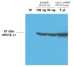 Sf9 세포에서 HPV18 L1 단백질 발현을 Western blot으로 확인한 결과. 1차 항체는 HPV18 L1 단클론 항체 2C7을 사용하였음