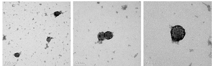 Sf9 세포에서 발현하고 정제한 HPV18 VLP의 전자현미경 결과.